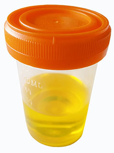 Canine urine sample